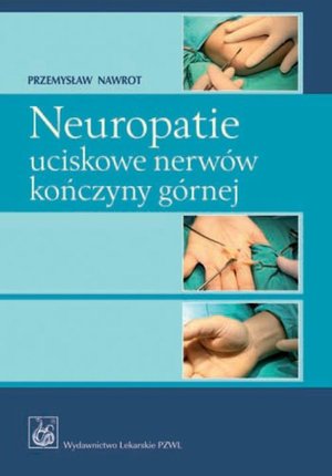 Neuropatie uciskowe nerwów kończyny górnej – ebook