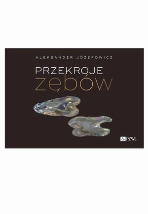Przekroje zębów – ebook