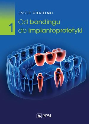 Od bondingu do implantoprotetyki Część 1 – ebook