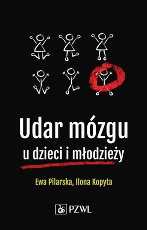 Udar mózgu u dzieci i młodzieży – ebook