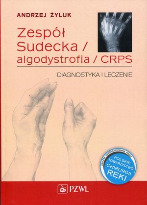 Zespół Sudecka / Algodystrofia / CRPS: Diagnostyka i leczenie – ebook