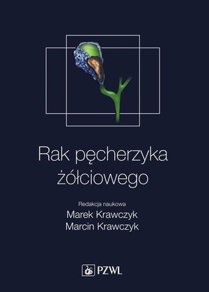 Rak pęcherzyka żółciowego – ebook