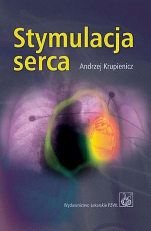 Stymulacja serca – ebook