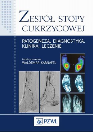Zespół stopy cukrzycowej: Patogeneza, diagnostyka, klinika, leczenie – ebook