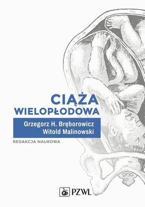 Ciąża wielopłodowa – ebook