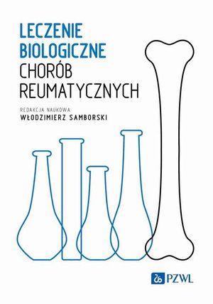 Leczenie biologiczne chorób reumatycznych – ebook