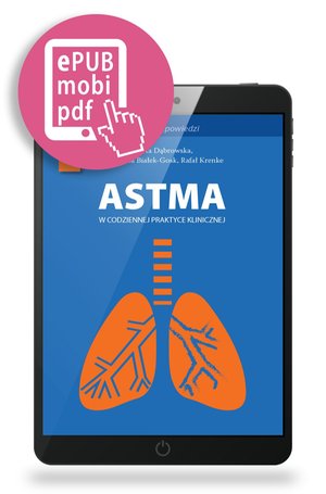 Astma w codziennej praktyce – ebook