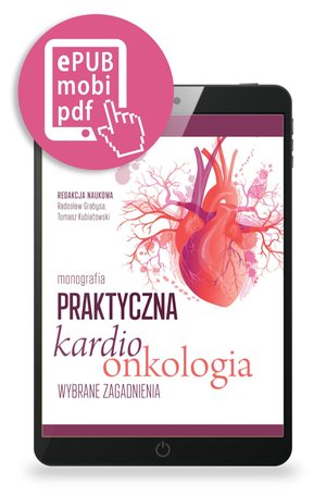 Praktyczna kardioonkologia. Wybrane zagadnienia – ebook