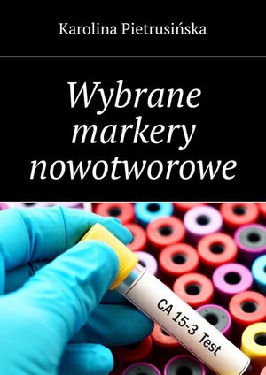Wybrane markery nowotworowe – ebook