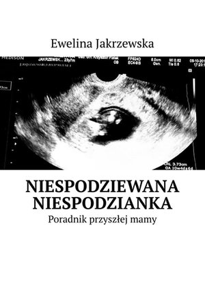 Niespodziewana Niespodzianka. Poradnik przyszłej mamy – ebook