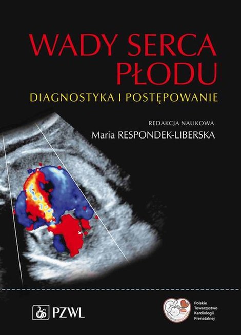 ebooki: Wady serca płodu: Diagnostyka i postępowanie – ebook