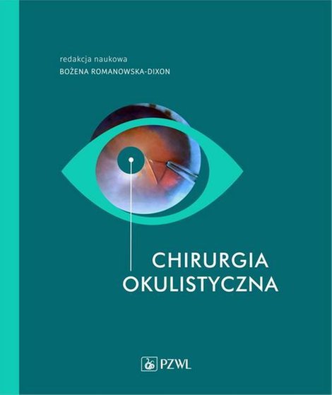 ebooki: Chirurgia okulistyczna – ebook