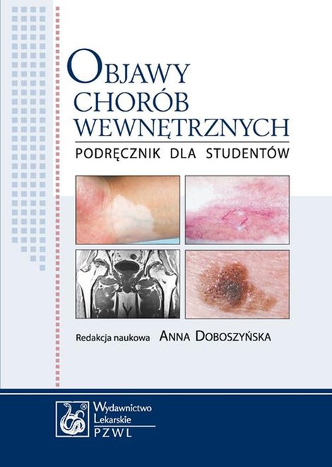 ebooki: Objawy chorób wewnętrznych. Podręcznik dla studentów – ebook