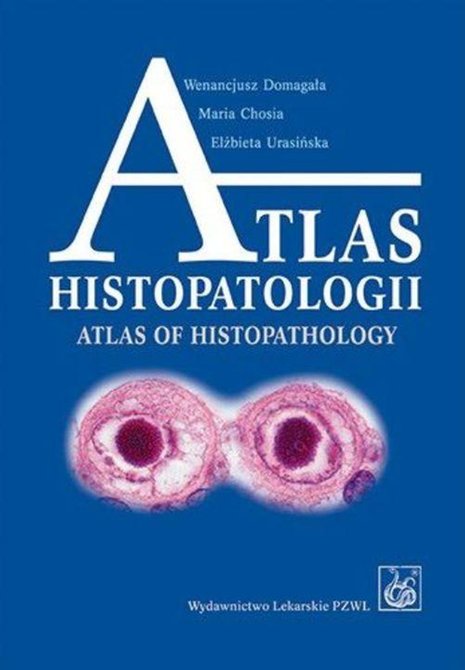 ebooki: Atlas histopatologii.Tajemniczy świat chorych komórek człowieka – ebook