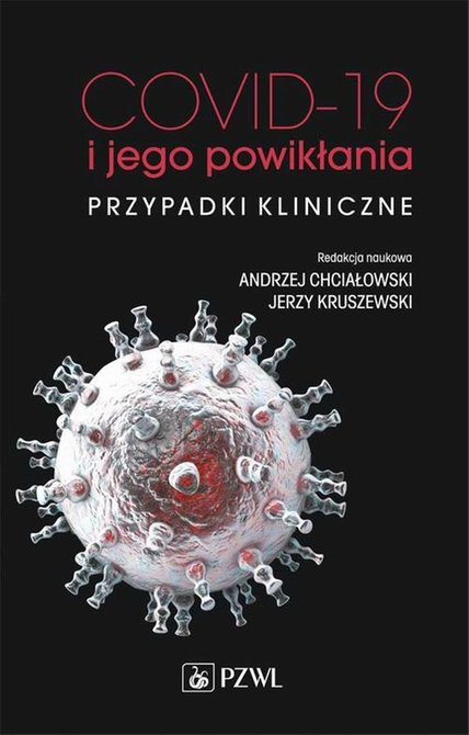 ebooki: COVID-19 i jego powikłania - przypadki kliniczne – ebook